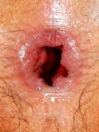Femboy gets a gaping ass from white cock